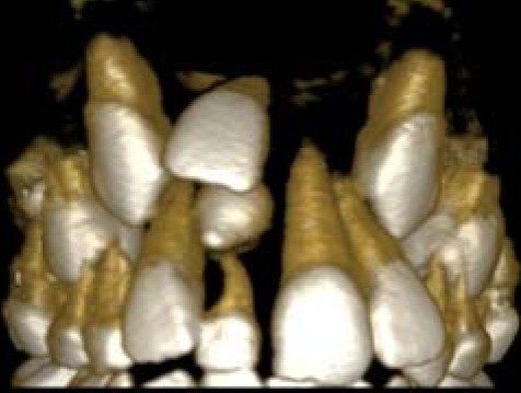 reconstru��o em 3D