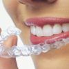 invisalign