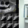 tomografia cone beam em odontologia
