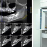 tomografia cone beam em odontologia