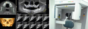 tomografia cone beam em odontologia
