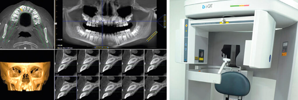 tomografia cone beam em odontologia