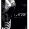 protese sobre implantes